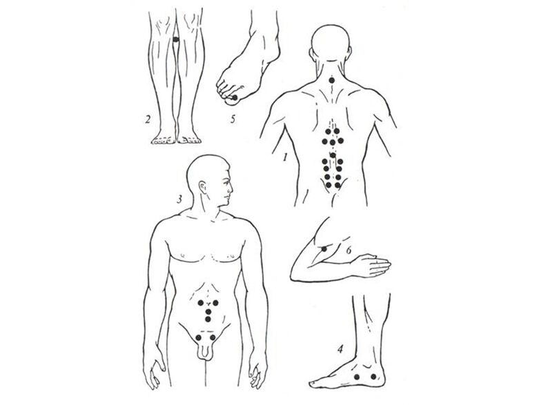 Acupuncture massage