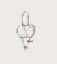 tension to increase potential muscles and potential